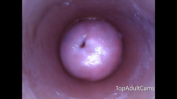 Kamera Langsung: Endoskop Menyelami Vagina